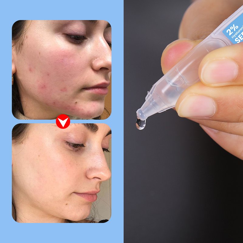 Niacinamide Anti-Aging Serum - 12